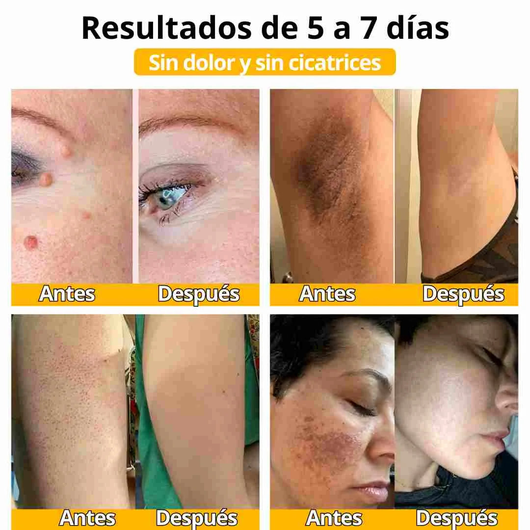 BEE VENOM CICATRICES Y MANCHAS